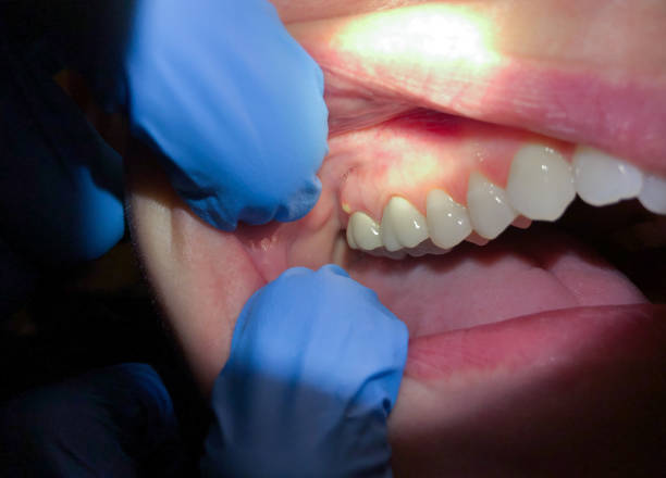 Best 24-Hour Emergency Dental Care in Beach City, TX